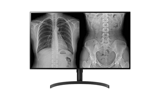 EAN 8806096367889 - LG 32HL512D-M pantalla para PC 80 cm (31.5") 3840 x 2160 Pixeles Full HD Negro imagen 1