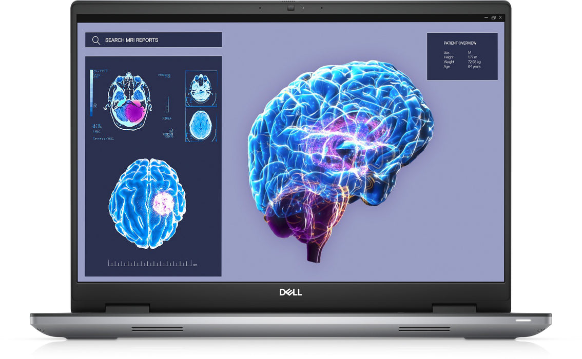 EAN 5397184810293 - DELL Precision 7680 Intel® Core™ i7 i7-13850HX Estación de trabajo móvil 40,6 cm (16") Full HD+ 32 GB DDR imagen 1